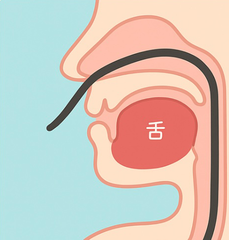経鼻挿入